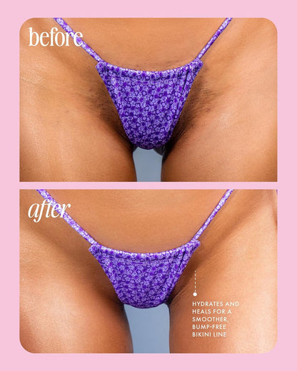 Truly Cooka Collection – Tratamiento Calmante e Hidratante para Zonas Íntimas y Línea del Bikini